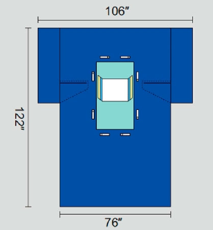 Welmed Abdominal Drape Laparoscopic / Cholecystectomy Drape 106 W X 76 W X 122 L Inch Sterile - 1222-2160