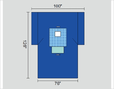 Welmed Protect5 Surgical Drape Breast Drape 100 W X 76 W X 126 L Inch Sterile - 1222-2520