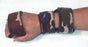 Wrist, Hand and Finger
