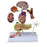 Nasco Healthcare - Type 2 Diabetes Model - SB46335