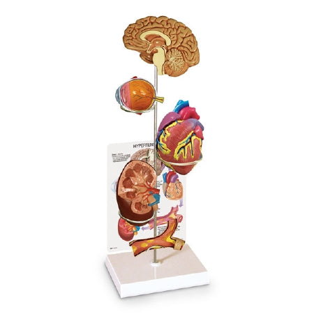 Nasco Hypertension Model Set - SB40233