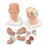 Nasco Healthcare - Head with Brain Model - SB41429