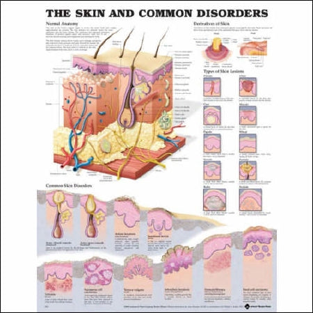 Anatomical Chart Company Anatomical Chart Skin and Common Disorders 20 X 26 Inch Heavy Paper Grommets Laminated - 1587796139