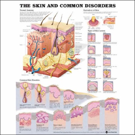 Anatomical Chart Company - Anatomical Chart Skin and Common Disorders 20 X 26 Inch Heavy Paper Grommets Laminated - 1587796139