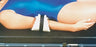 Alimed AliMed Ulnar Protector Alimed - 95-787