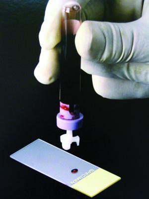 Diff-Safe - Blood Dispenser 21 Gauge X 1/2 Inch Needle For Blood Smears - 73000-077