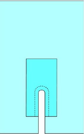 Cardinal - Orthopedic Drape Split Drape 87 X 125 Inch Sterile - 29476