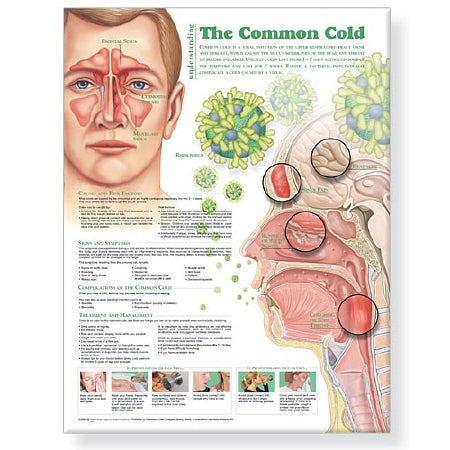 Anatomical Chart Company Anatomical Chart Understanding the Common Cold 20 X 26 Inch Heavy Paper Laminated - 9780781786317