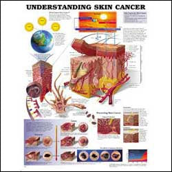 Anatomical Chart Company Anatomical Chart Understanding Skin Cancer 20 X 26 Inch Heavy Paper Laminated - 9781605470948