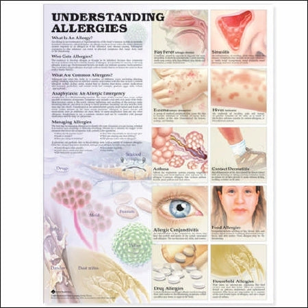 Anatomical Chart Company Anatomical Chart Understanding Allergies 2nd Edition 20 X 26 Inch Heavy Paper Laminated - 9781587799419