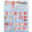 Anatomical Chart Company Anatomical Chart Common Gynecological Disorders 20 X 26 Inch Paper Grommets Laminated - 9780781773508