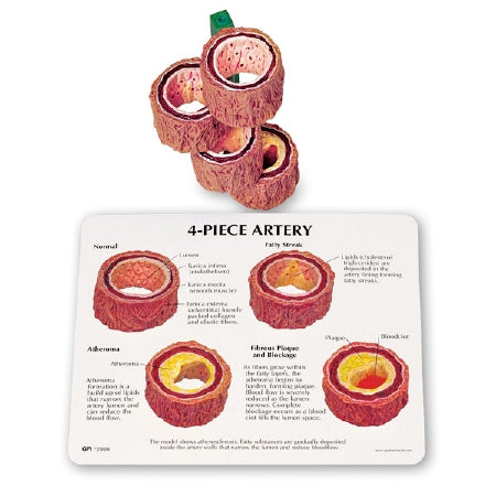 Nasco 4-Piece Artery Model - SB42963G