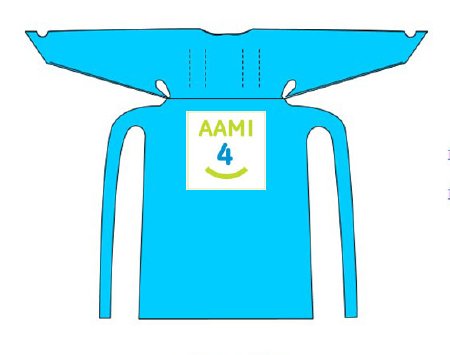 Welmed Over-the-Head Protective Procedure Gown Large Unisex AAMI Level 4 NonSterile Blue - 9100-260L