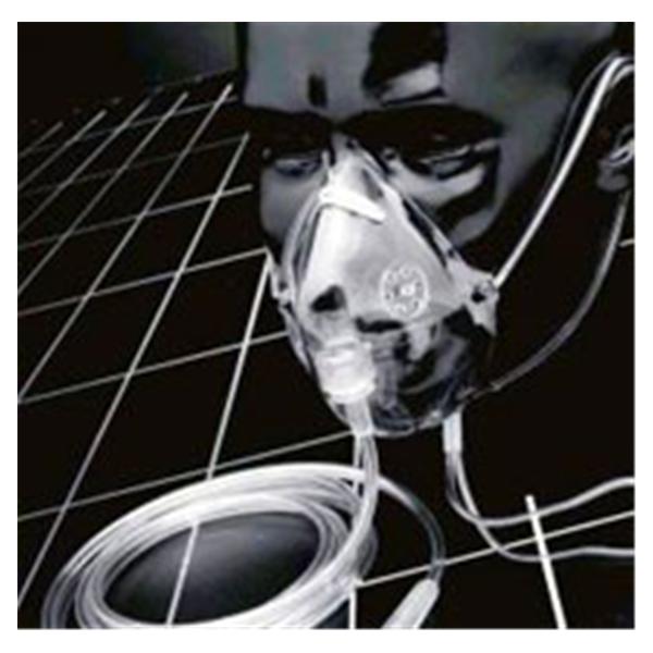 Salter Labs Mask Oxygen Pediatric 50/Case - 1123-0-50