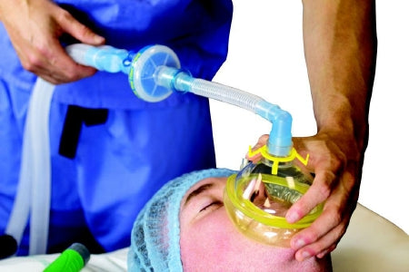 Ventiflow - Anesthesia Breathing Circuit Expandable Tube 72 Inch Tube Single Limb Adult 3 Liter Bag Single Patient Use - 038-01-853U