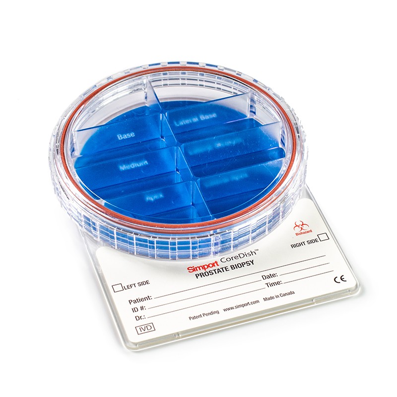 Prostate Biopsy Container