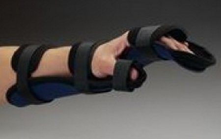 Rolyan Kydex - Functional Resting Hand Orthosis Kydex Thermoplastic / Volara Right Hand Black Large - 56072608