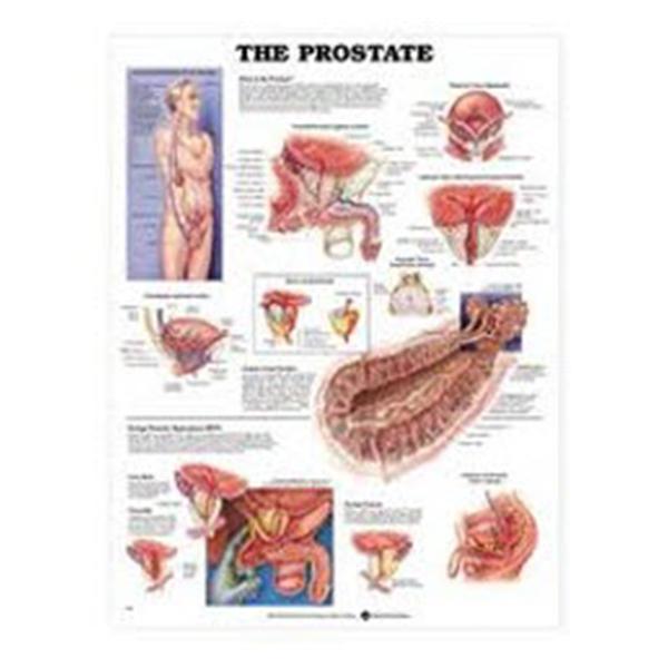 Wolters Kluwer Health Inc Chart Anatomical Prostate Laminated 20X26" Ea - 1587791897
