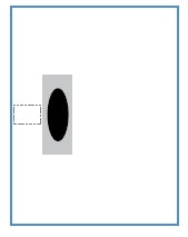 Alcon Alcon EENT Drape Eye Drape 40 W X 48 L Inch - 8065102820
