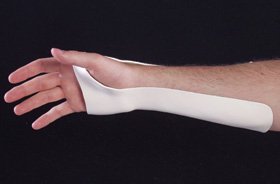 Ulnar Gutter - Wrist Splint Multi-Form Plastic Left or Right Hand White Small / Medium - 51-131