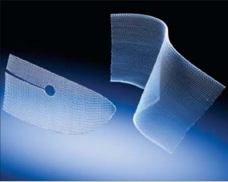Bard Mesh Flat Sheet - Inguinal Hernia Repair Mesh Nonabsorbable Polypropylene Monofilament 6 X 6 Inch Square Style White Sterile - 0112720