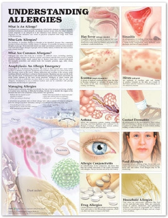 Anatomical Chart Company - Anatomical Chart Allergies 20 X 26 Inch Heavy Paper Grommets Laminated - 9781587799402