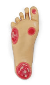Nasco Life/Form Geri Optional Pressure Injury Foot - LF04041