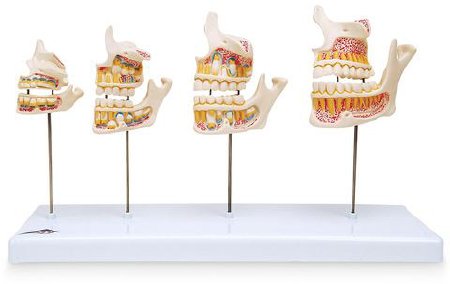 Nasco - Dentition Development - SB41406