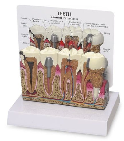 Nasco - Teeth - SB35432