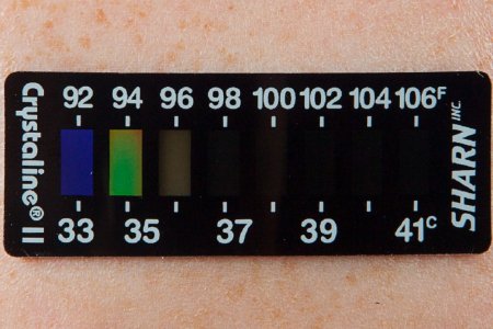 Crystaline - Single Patient Forehead Thermometer 35 to 41 °C / 94 to 105 °F Line Indicator Display - 5101H-II