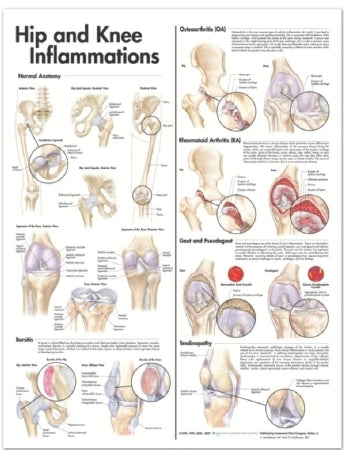 Anatomical Chart Company Anatomical Chart Hip and Knee 20 X 26 Inch Heavy Paper Grommets Laminated - 9780781773478