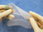 ProGrip Pre-Shape - Self-Fixating Hernia Repair Mesh Partially Absorbable Knitted Polyester Monofilament / Polylactic Acid (PLA) 10 X 15 cm Bilateral Style - LPG1510AK2