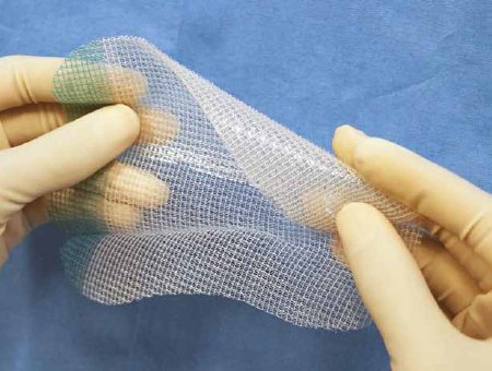 ProGrip - Self-Fixating Hernia Repair Mesh Partially Absorbable Knitted Polyester Monofilament / Polylactic Acid (PLA) 10 X 15 cm Rectangle Style - LPG1510X2