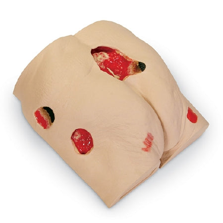 Nasco Seymour II Wound Care Model - SB46502
