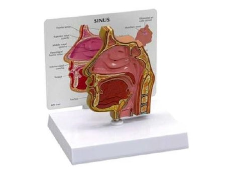 Anatomical Chart Company Basic Sinus Model - G285