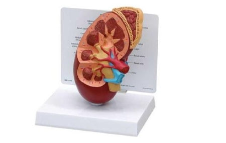 Anatomical Chart Company Kidney Anatomy Model Over Size Plastic Base - G325