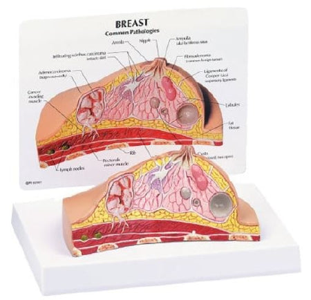 Anatomical Chart Company Breast Cross Section Model Full Size Plastic - G345