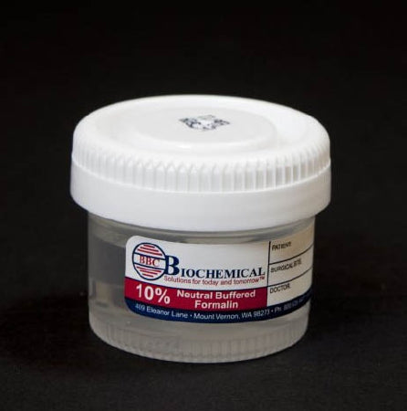 Dynamic Diagnostics BBC Biochemical Trans-Pak Prefilled Formalin Container Polypropylene Screw Cap 20 mL Fill in 40 mL (1 oz.) NonSterile - A0102011