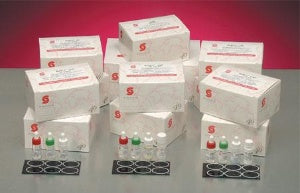 Stanbio Laboratory RaPET RF Rapid Test Kit Latex Agglutination Test Rheumatoid Factor Serum Sample 100 Tests - 1155-100