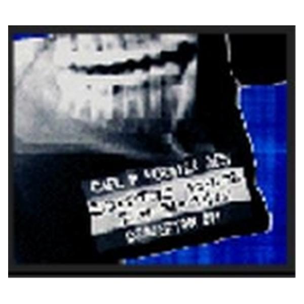 Medical Id Systems Inc Filter Density X-Rite Marker L&R Indicat Each - X-R175A-1