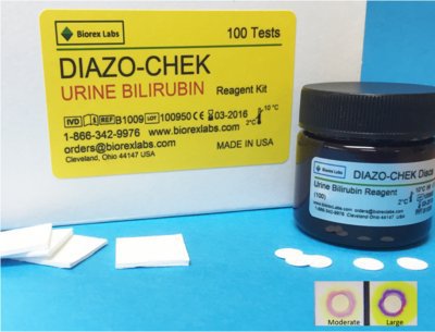 DIAZO-CHEK - Test Kit Hepatic / General Chemistry Bilirubin Urine Sample 100 Tests - B1009