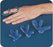 Bird & Cronin - Finger Splint Large Left or Right Hand - 08146351
