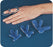 Bird & Cronin Finger Splint Medium - 8146361