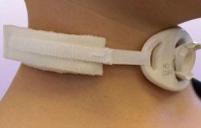 Marpac - Tracheostomy Tube Collar - 100B