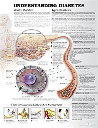 Anatomical Chart Company Anatomical Chart Understanding Diabetes 20 X 26 Inch Heavy Paper Grommets Laminated - 9781469894928