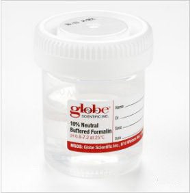 Tite-Rite - Prefilled Formalin Container 48 X 60 mm 30 mL Fill in 60 mL Screw Cap Warning Label / Patient Information NonSterile - 6522FL
