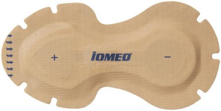 DJO - Companion 80 Iontophoresis System 1.1 cc fill - 5000044