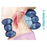 MediFlow Inc Collar Traction Chirotrac Dt Cervical Blue 4/Ca - 1476-04