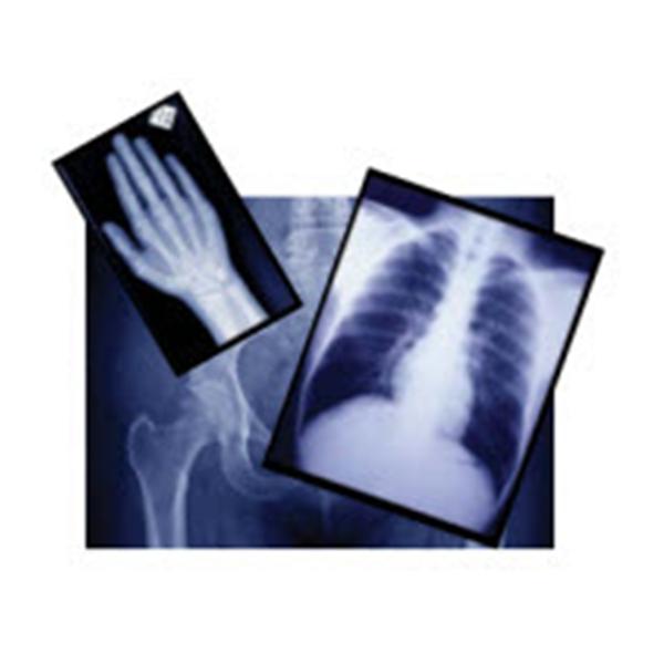 Henry Schein Film X-Ray 24X30Cm 100/Bx, 5 Bx/Ca - 9004286