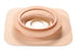 Convatec Natura Ostomy Barrier Mold to Fit Durahesive Hydrocolloid, Tape 2-3/4 Inch Flange 1-1/4 to 1-3/4 Inch - 421041